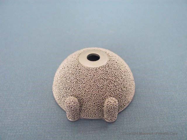 PCA cup (porous coated anatomical cup):