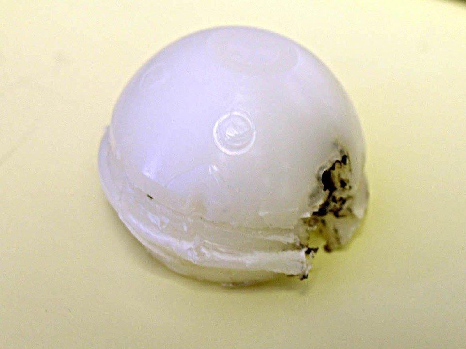 This is an explanted PE cup with evidence of eccentric wear. It may have been re