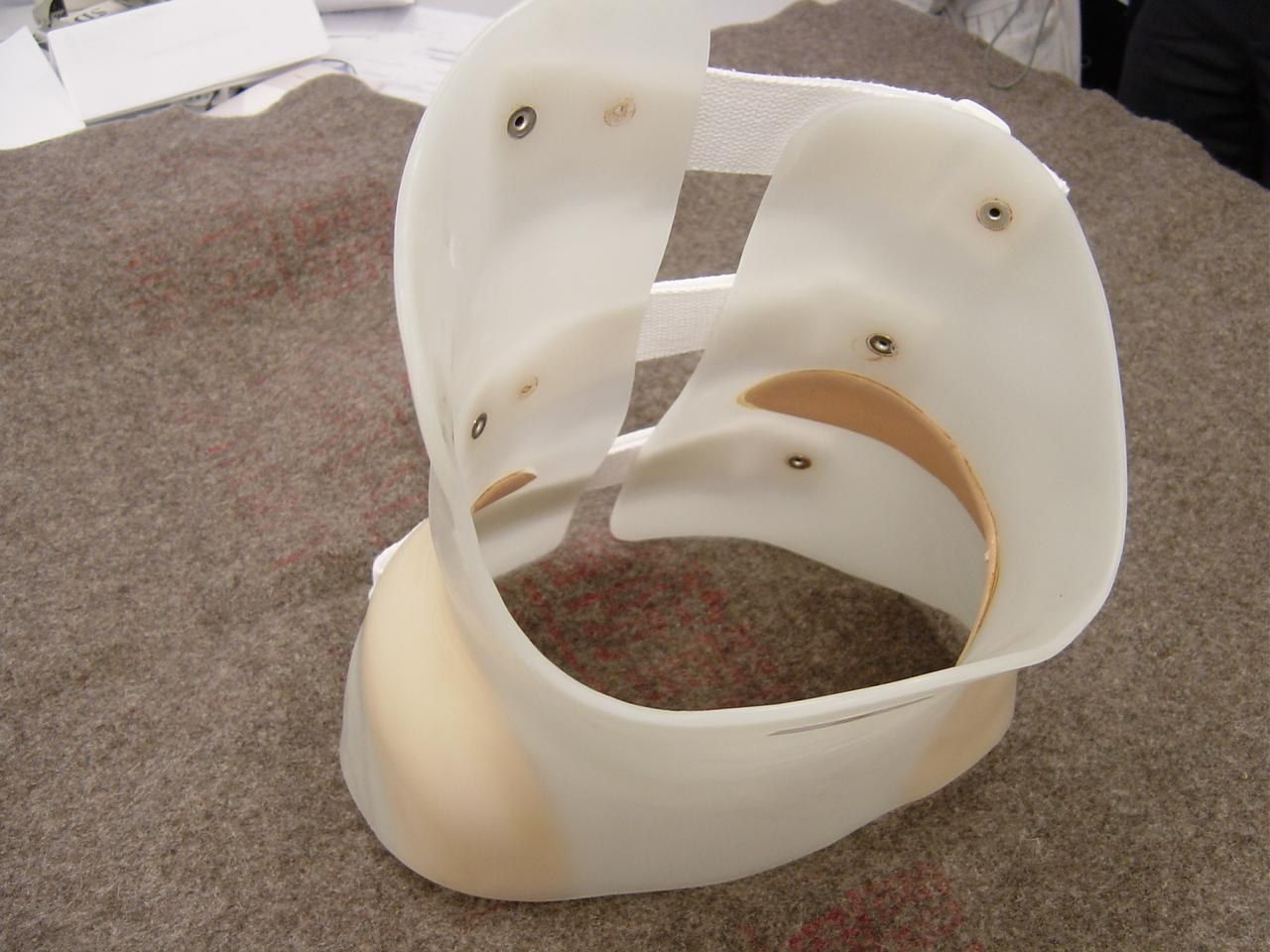TLSO with asymmetry: Boston brace