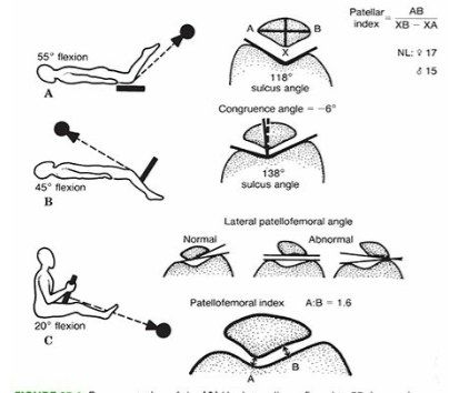 TRUE LATERAL XRAY