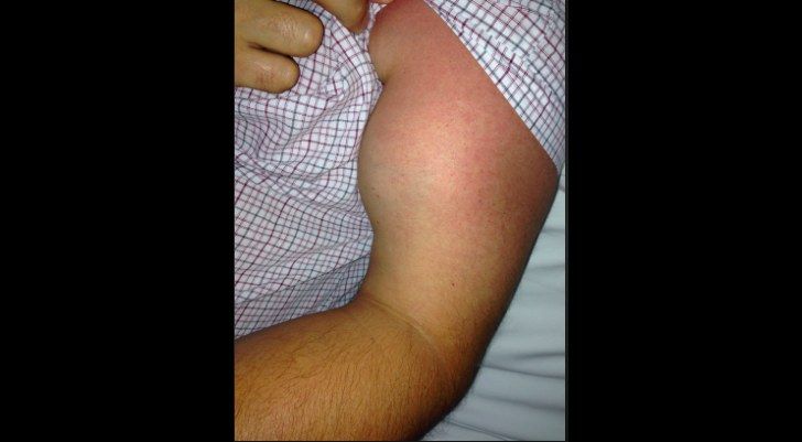 Which photo shows popeye sign?