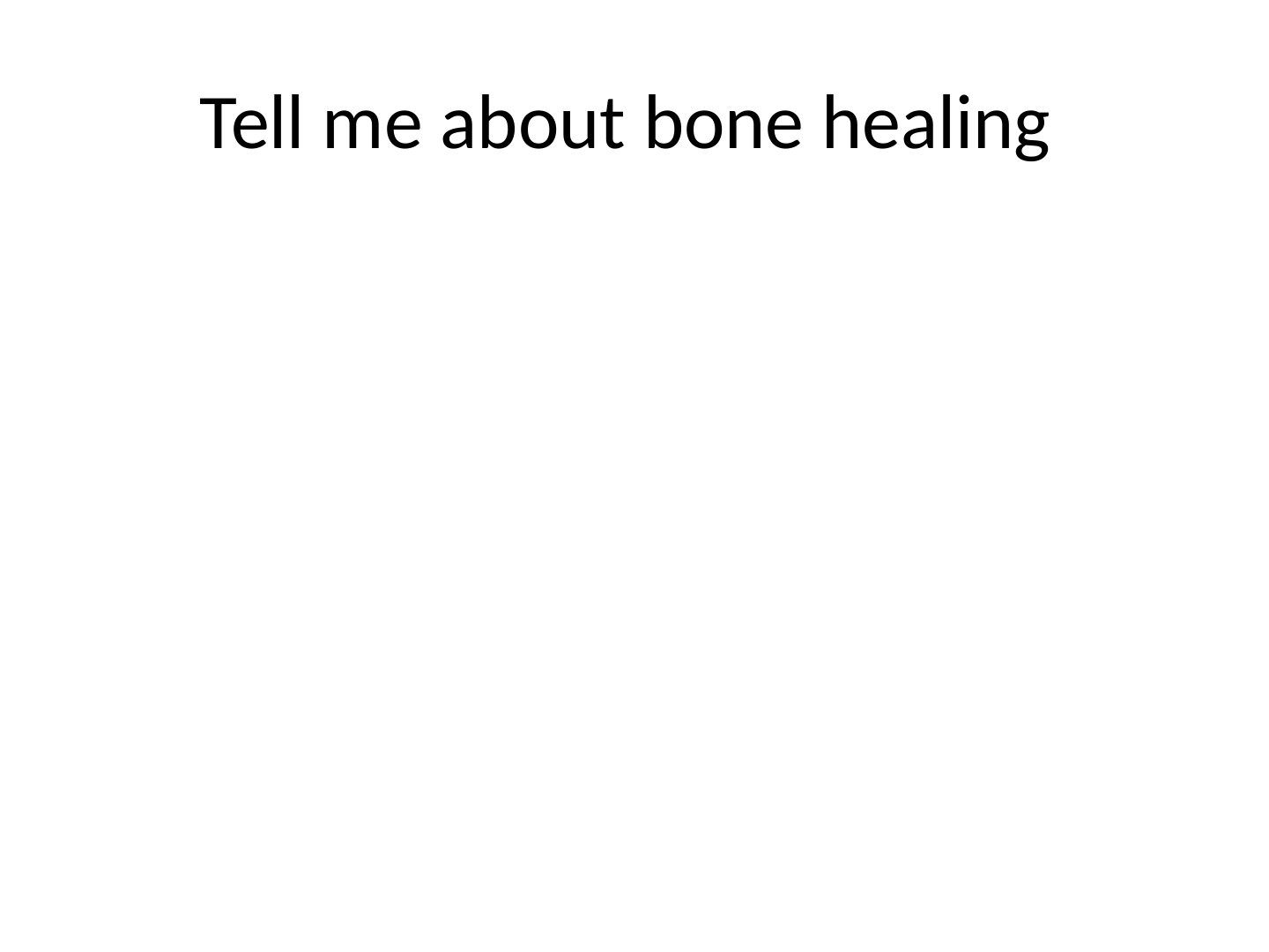 slide 26