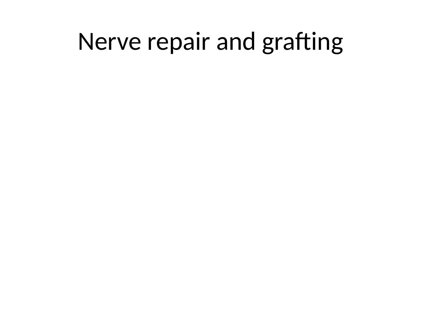 slide 40