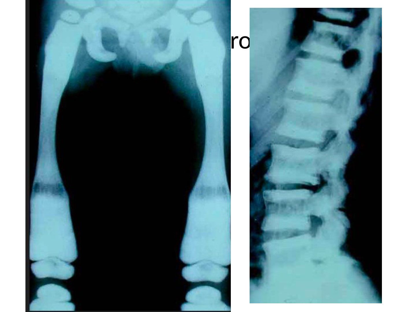 slide 151