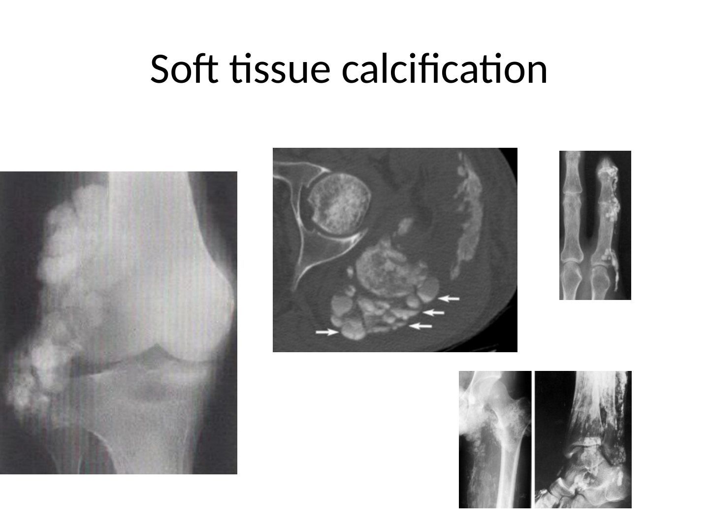 slide 155
