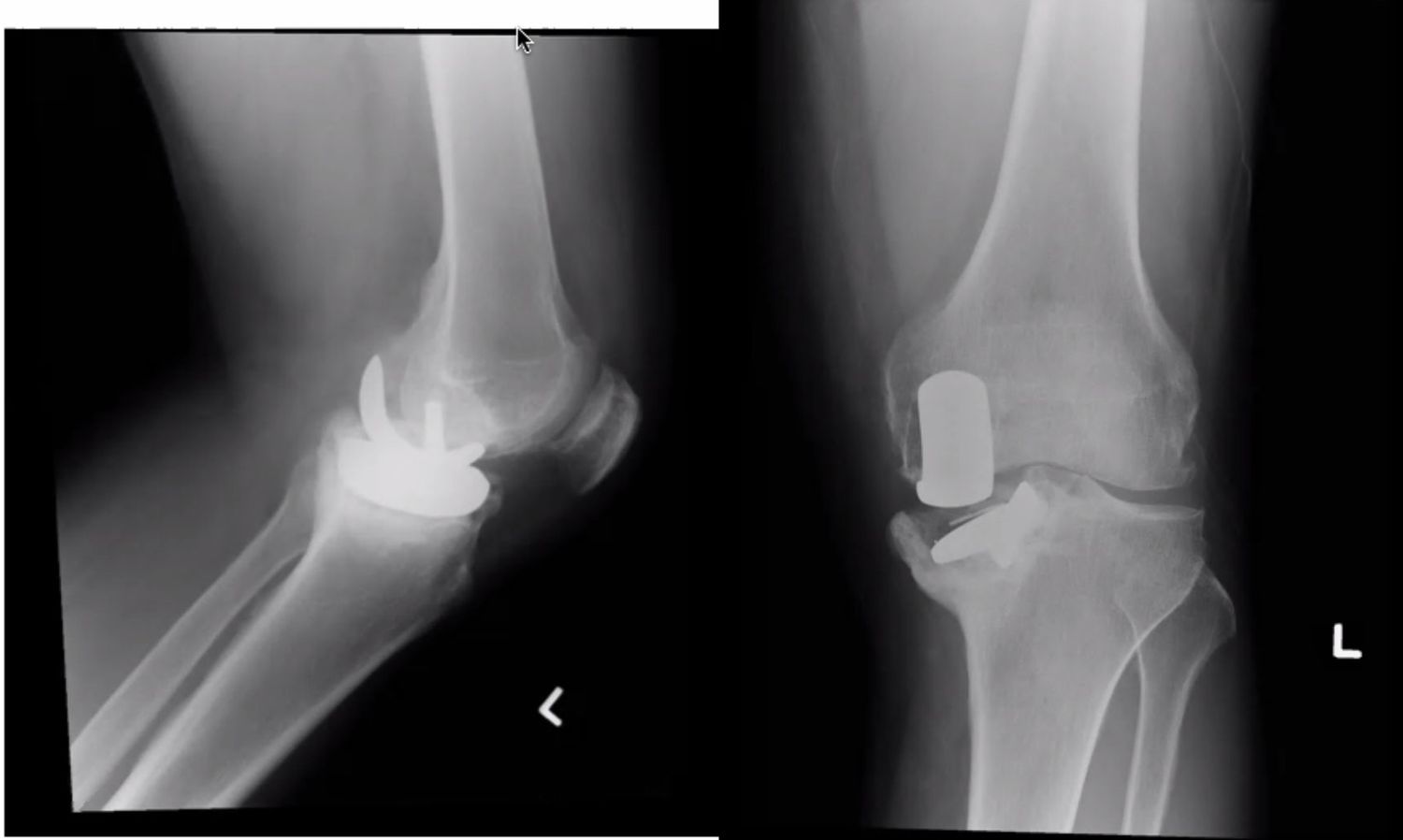 slide 169