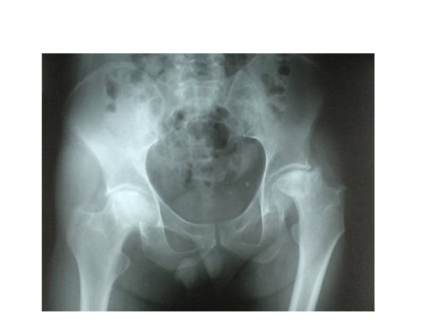 slide 195