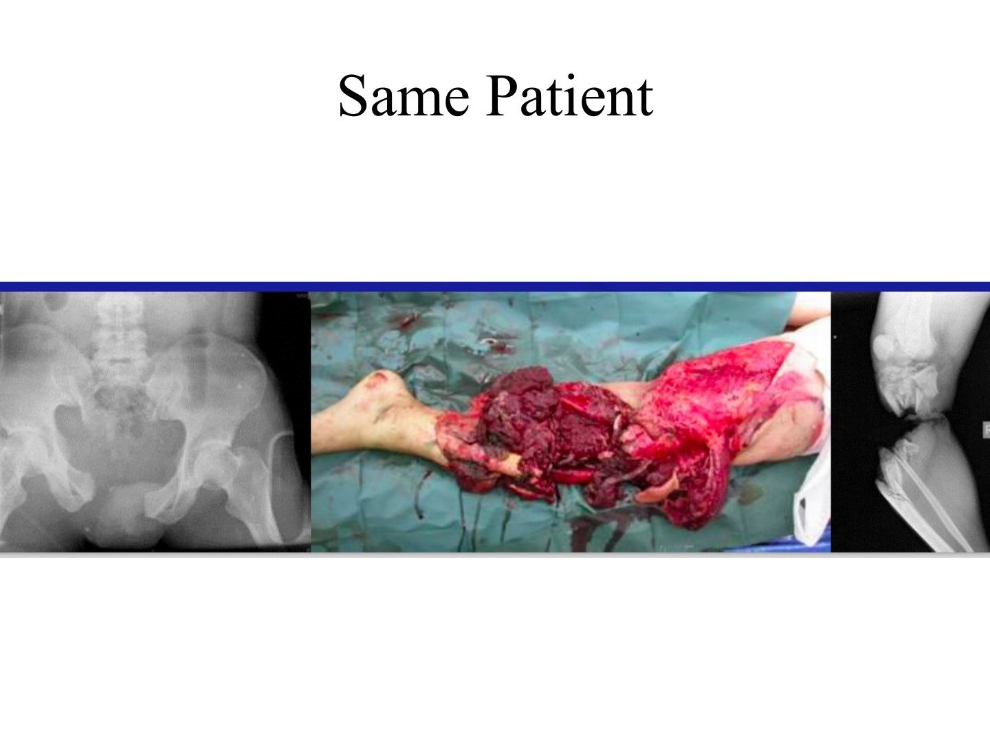 slide 339