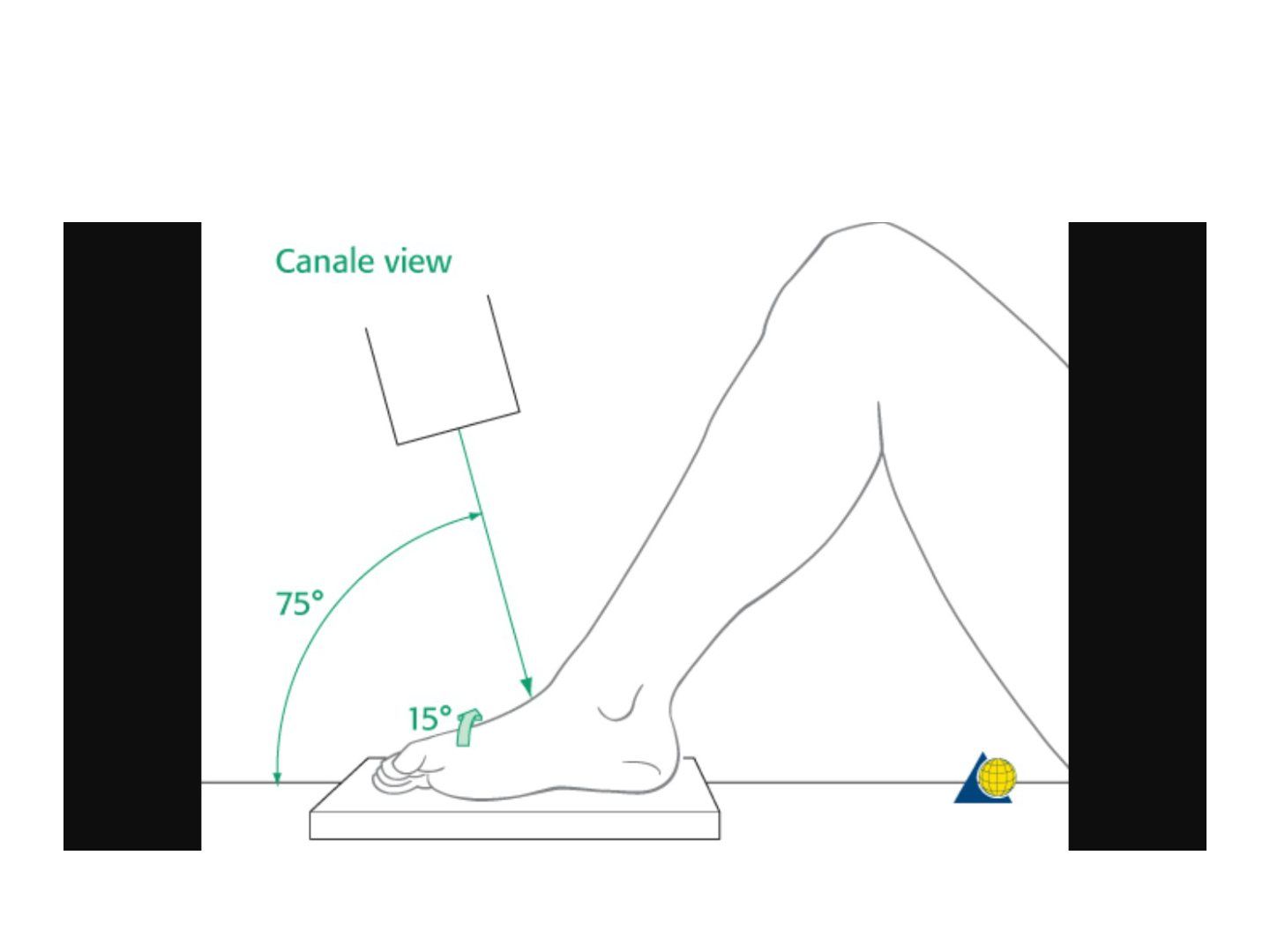 slide 352