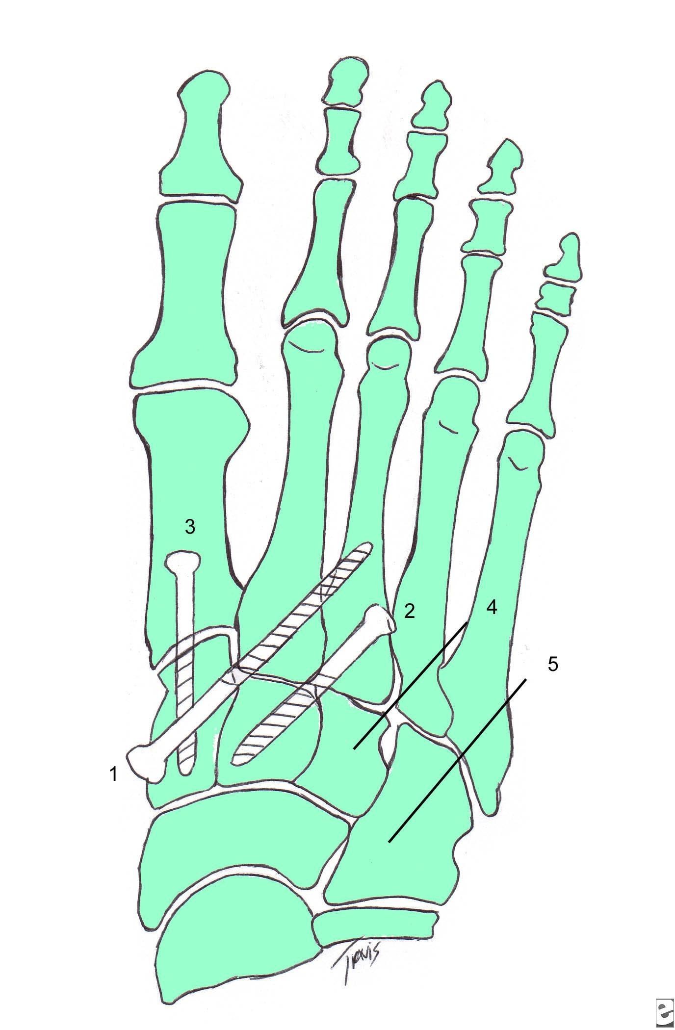 slide 357