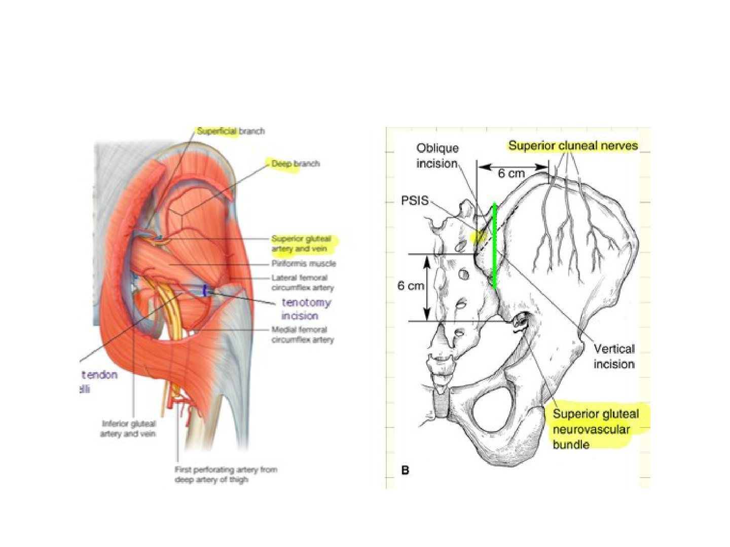slide 393