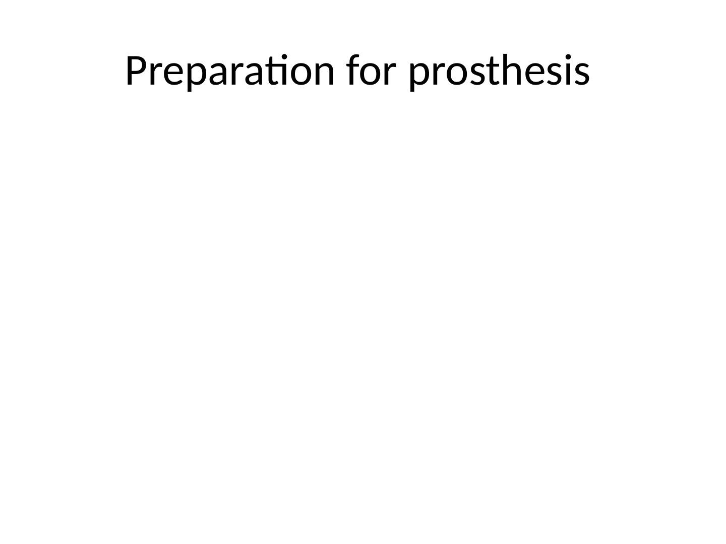 slide 404