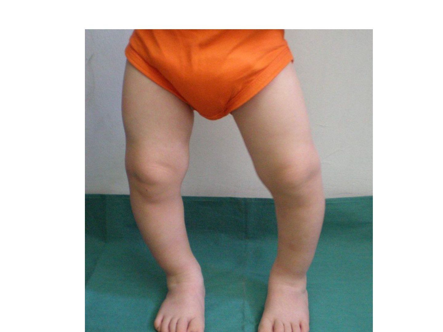 slide 526
