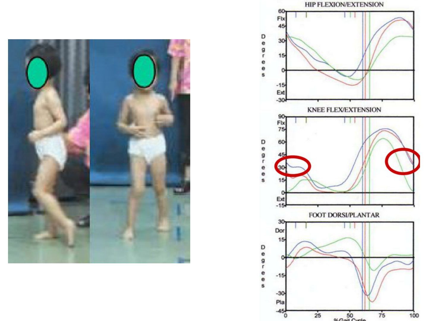 slide 594