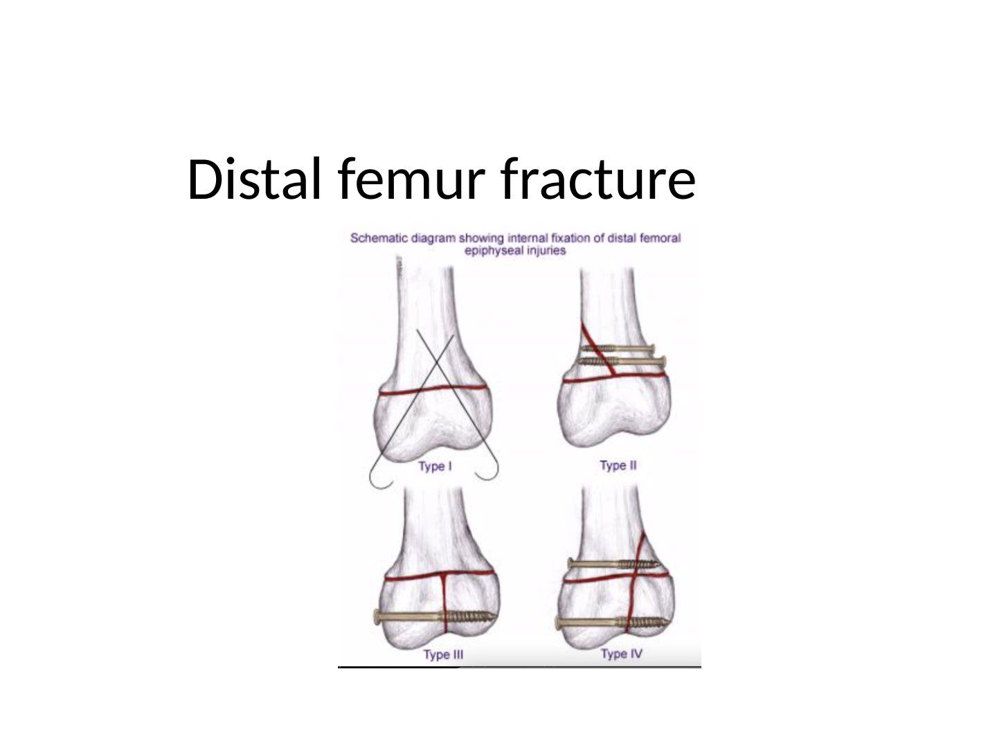 slide 628