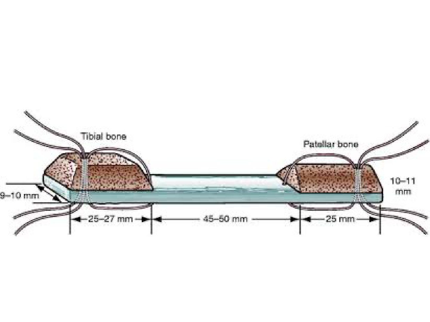 slide 645