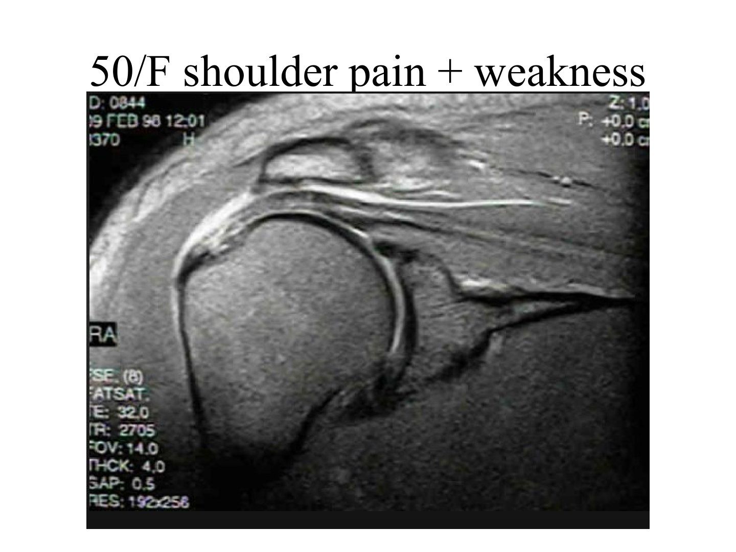 slide 673