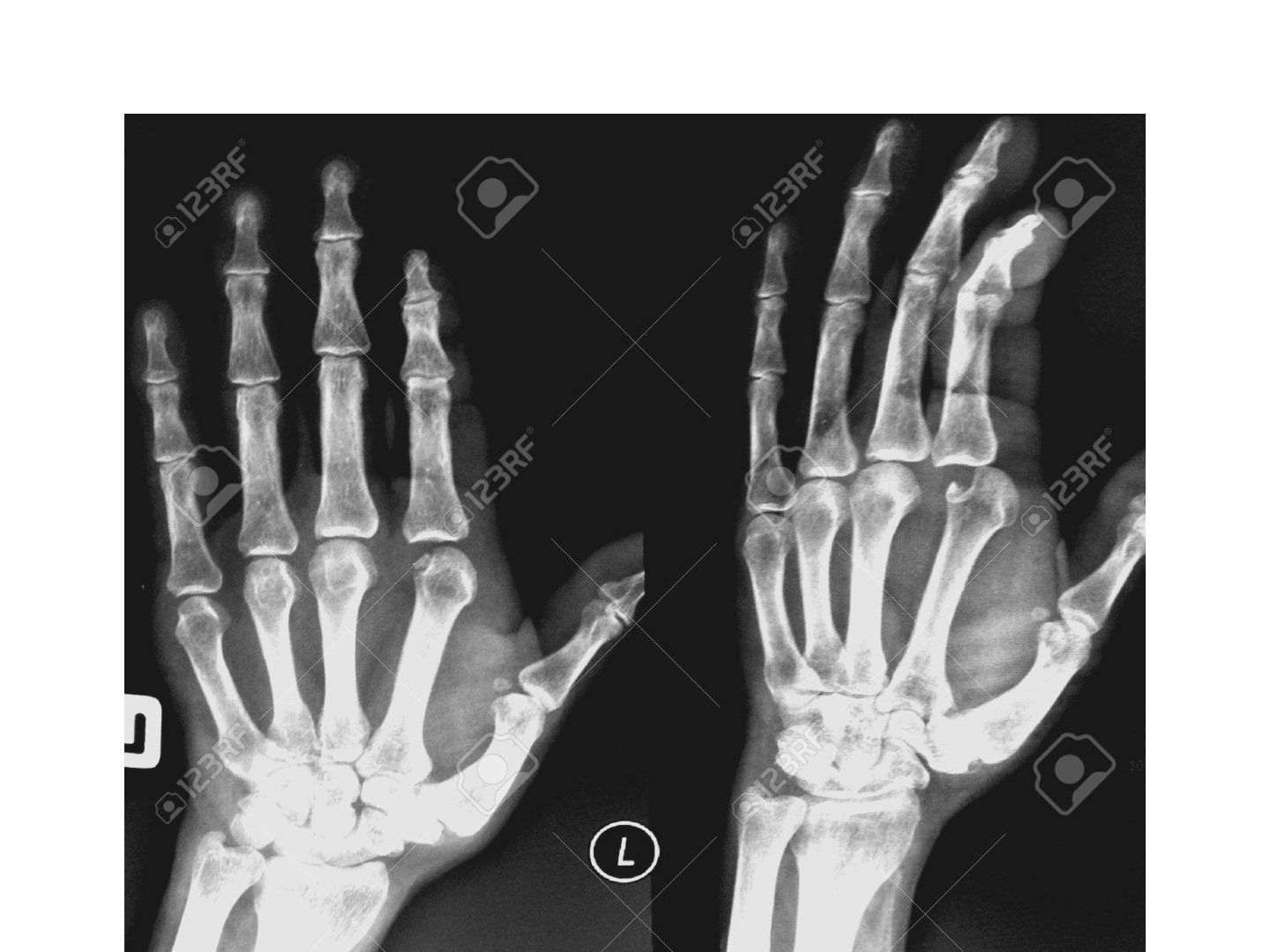slide 714