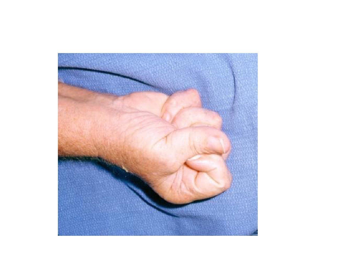 slide 738
