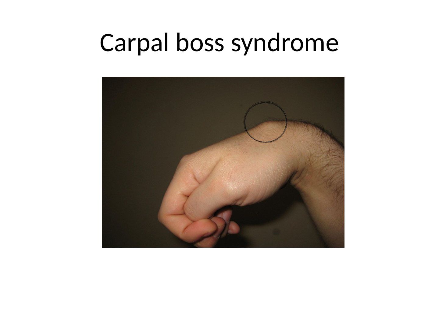 slide 775
