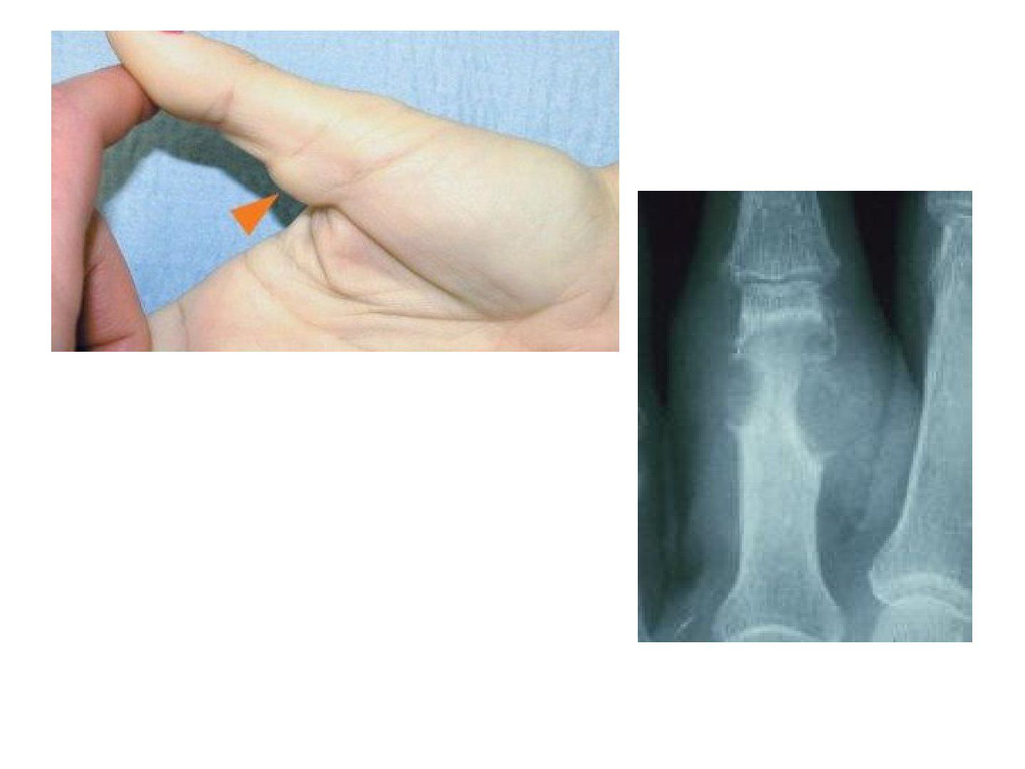 slide 782