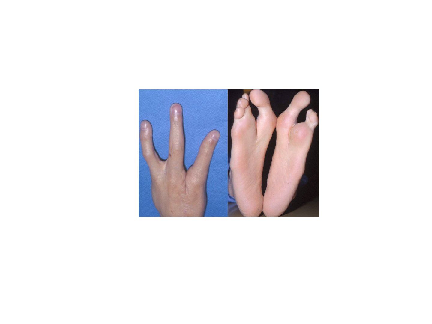 slide 798